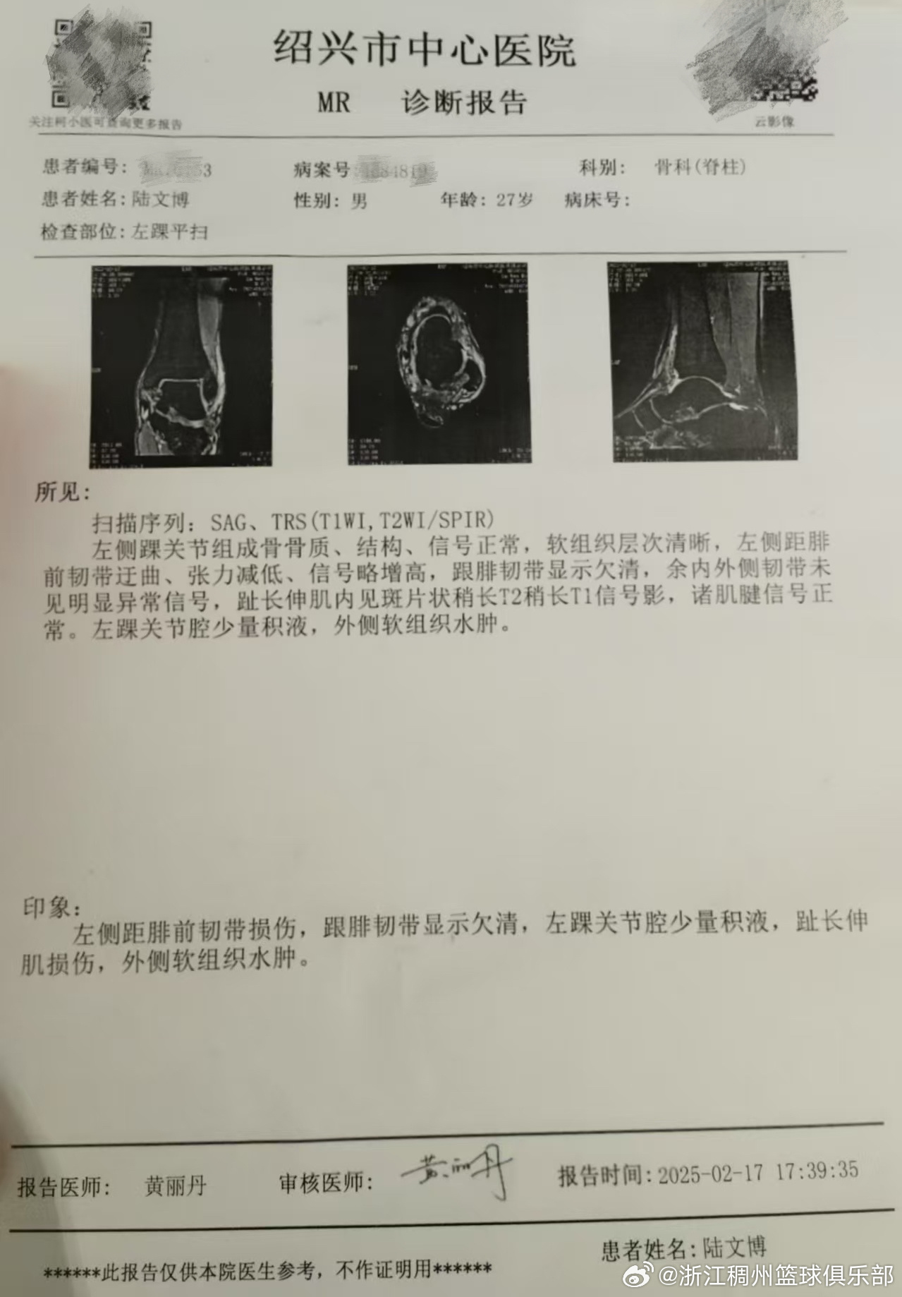 体受挫